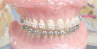 マルチブラケット装置